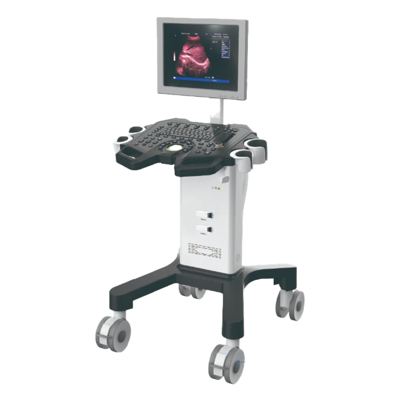 Air Essence™ UltraLite L4 – échographe, appareil d’échographie (ultrason)