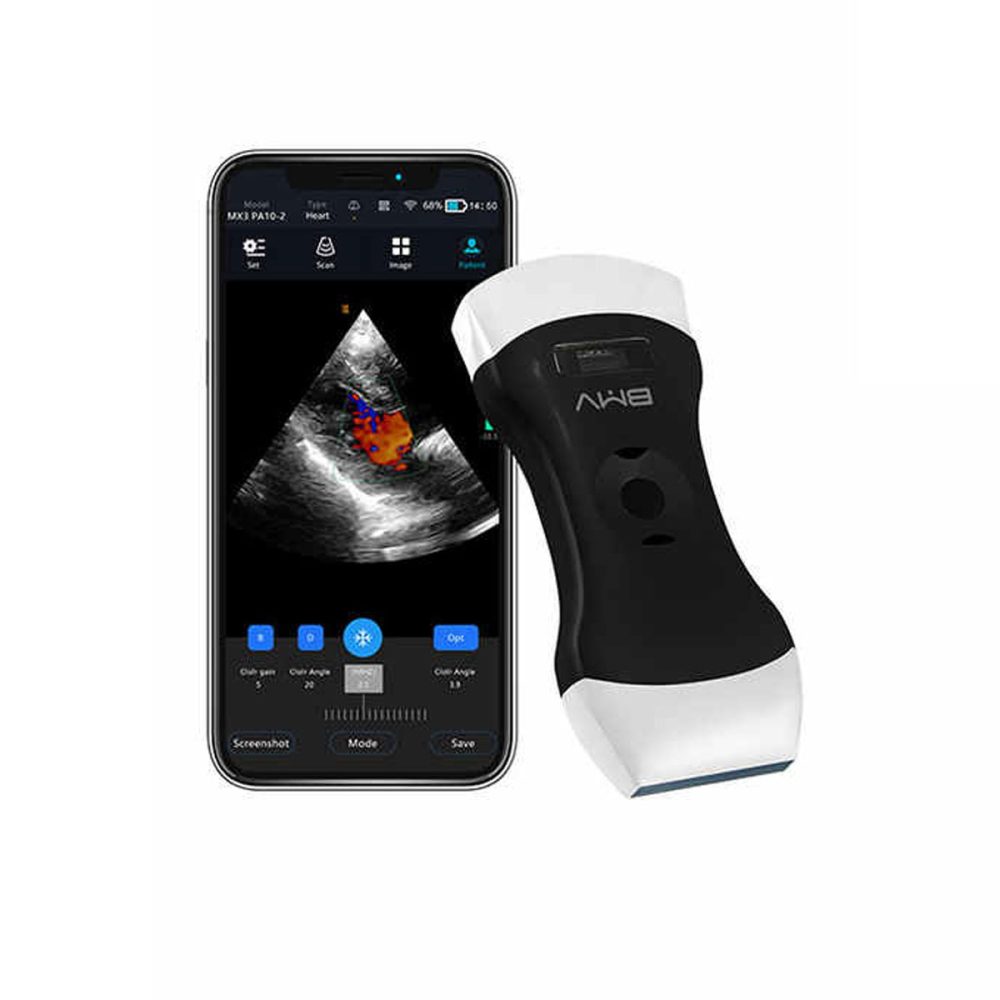 Air Essence™ UltraLite L3 – échographe portable, appareil d’échographie