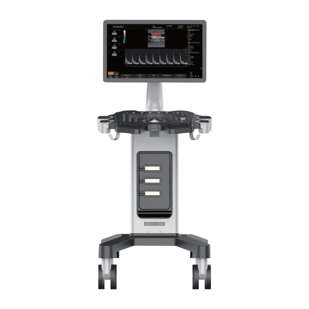 Air Essence™ UltraLite L5 – échographe stationnaire sur chariot avec écran 21,5″, système d’échographie professionnel