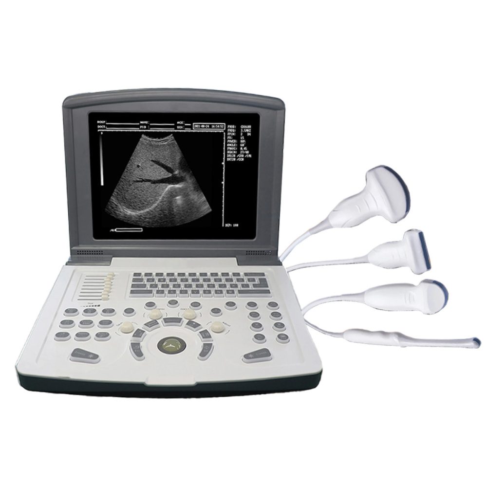 Air Essence™ UltraLite L2 – échographe portable professionnel, appareil d’échographie